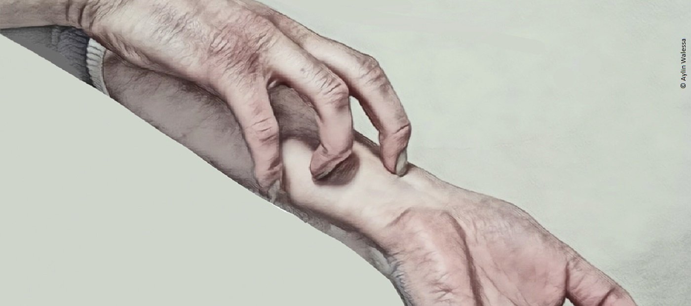 Neurodermitis führt zu einem Juck-Kratz-Kreislauf